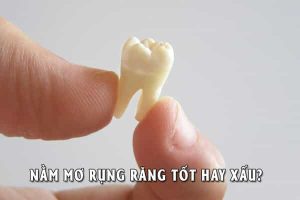 mơ rụng răng